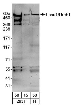 Lasu1/Ureb1 Goat anti-Human, Polyclonal, Bethyl Laboratories 10 &mu;L;