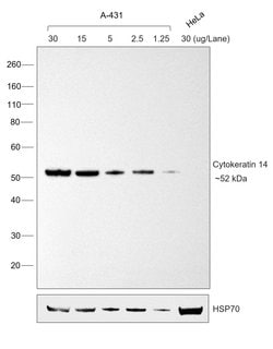 Invitrogen Goat anti-Mouse IgG3 Secondary Antibody, HRP 1 mL; HRP:Antibodies,