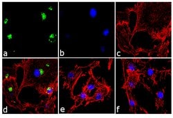 IL-8 (CXCL8) Monoclonal Antibody (3IL8-H10), Invitrogen 500 &mu;g; Unconjugated:Antibodies,