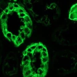 Invitrogen Cytokeratin 7 Monoclonal Antibody (OVTL12/30) 100 &mu;L; Unconjugated:Antibodies,