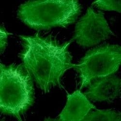 Invitrogen Cytokeratin 17 Monoclonal Antibody (E3) 100 &mu;L; Unconjugated:Antibodies,
