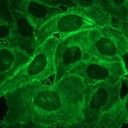 Invitrogen E-selectin Monoclonal Antibody (UZ5) 100 &mu;g; Unconjugated:Antibodies,