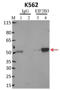 Invitrogen eIF2b gamma Monoclonal Antibody (1H3) 100 &mu;g; Unconjugated:Antibodies,