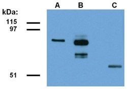 Invitrogen ABRA1 Monoclonal Antibody (ABRA1-01) 100 &mu;g; Unconjugated:Antibodies,