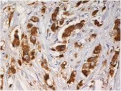 Invitrogen AGR3 Monoclonal Antibody (AGR3.1) 100 &mu;g; Unconjugated:Antibodies,