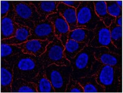 Invitrogen AHNAK Monoclonal Antibody (EM-09) 100 &mu;g | Buy Online | Invitrogen&trade; | Fisher Scientific