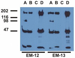 Invitrogen Phospho-EGFR (Tyr1173) Monoclonal Antibody (EM-13) 100 &mu;g;