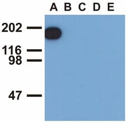 Invitrogen Phospho-EGFR (Tyr1173) Monoclonal Antibody (EM-13) 100 &mu;g;