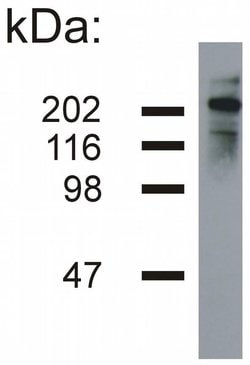 Invitrogen NF-H Monoclonal Antibody (NF-05) 100 &mu;g; Unconjugated:Antibodies,