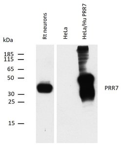 Invitrogen PRR7 Monoclonal Antibody (TRAP3/10) 100 &mu;g | Buy Online | Invitrogen&trade; | Fisher Scientific