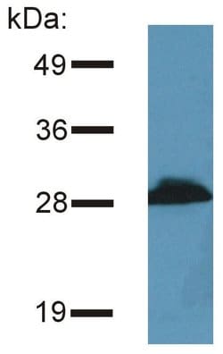 Invitrogen PRR7 Monoclonal Antibody (TRAP3/10) 100 &mu;g | Buy Online | Invitrogen&trade; | Fisher Scientific