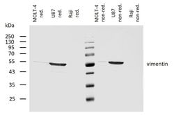 Invitrogen Vimentin Monoclonal Antibody (VI-10) 100 &mu;g; Unconjugated:Anticuerpos