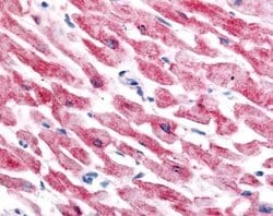 Invitrogen HIF-2 alpha Monoclonal Antibody (ep190b) 100 &mu;L; Unconjugated:Antibodies,
