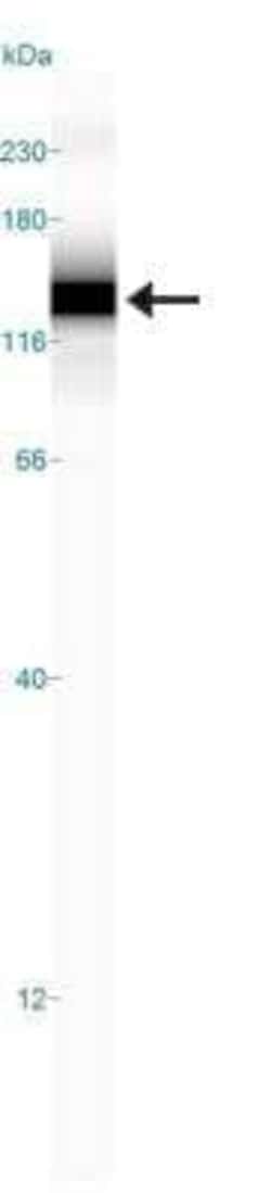 Invitrogen HIF-2 alpha Monoclonal Antibody (ep190b) 100 &mu;L; Unconjugated:Antibodies,