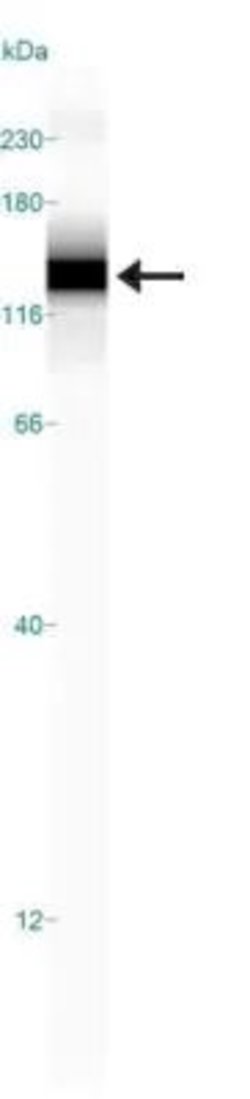Invitrogen HIF-2 alpha Monoclonal Antibody (ep190b) 100 &mu;L; Unconjugated:Antibodies,