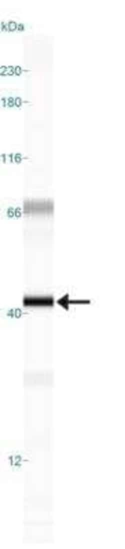 Invitrogen RAD51C Monoclonal Antibody (2H11/6) 100 &mu;L | Buy Online | Invitrogen&trade; | Fisher Scientific