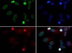 Invitrogen RAD51D Monoclonal Antibody (5B3/6) 100 &mu;L; Unconjugated:Antibodies,
