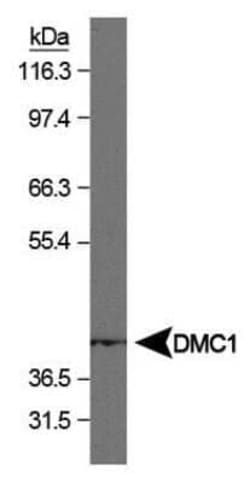 Invitrogen DMC1 Monoclonal Antibody (1D12/4) 100 &mu;L | Buy Online | Invitrogen&trade; | Fisher Scientific