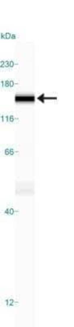 Invitrogen FANCD2 Monoclonal Antibody (FI-17) 100 &mu;L; Unconjugated:Antibodies,