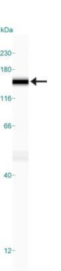 Invitrogen FANCD2 Monoclonal Antibody (FI-17) 100 &mu;L; Unconjugated:Antibodies,