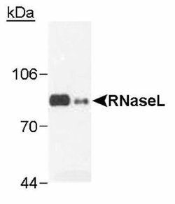 Invitrogen RNaseL Monoclonal Antibody (2E9) 100 &mu;L; Unconjugated:Antibodies,
