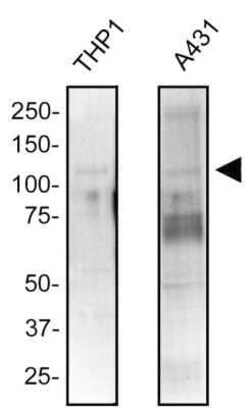 Invitrogen NOD2 Monoclonal Antibody (2D9) 100 &mu;L | Buy Online | Invitrogen&trade; | Fisher Scientific