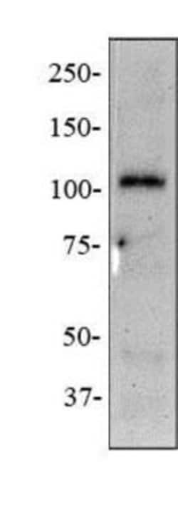 Invitrogen NOD2 Monoclonal Antibody (2D9) 100 &mu;L; Unconjugated:Antibodies,