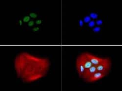 Invitrogen BRCA1 Monoclonal Antibody (RAY) 100 &mu;L; Unconjugated:Anticuerpos