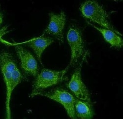 Invitrogen VEGF Monoclonal Antibody (VG1) 100 &mu;g; Unconjugated:Antibodies,