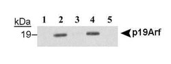 Invitrogen p19ARF Monoclonal Antibody (12-A1-1) 100 &mu;L | Buy Online | Invitrogen&trade; | Fisher Scientific