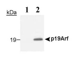 Invitrogen p19ARF Monoclonal Antibody (12-A1-1) 100 &mu;L | Buy Online | Invitrogen&trade; | Fisher Scientific