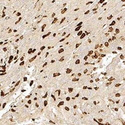 Invitrogen Bestrophin 1 Monoclonal Antibody (E6-6) 100 &mu;L; Unconjugated:Antibodies,