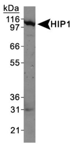 Invitrogen HIP1 Monoclonal Antibody (1B11) 100 &mu;L; Unconjugated:Antibodies,