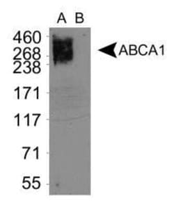 Invitrogen ABCA1 Monoclonal Antibody (3A1.891.3) 100 &mu;L; Unconjugated:Antibodies,