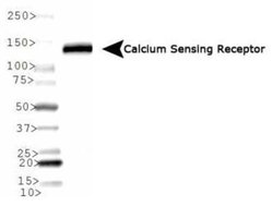 Invitrogen Calcium Sensing Receptor Monoclonal Antibody (HL 1499) 100 &mu;L;
