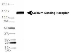 Invitrogen Calcium Sensing Receptor Monoclonal Antibody (HL 1499) 100 &mu;L | Buy Online | Invitrogen&trade; | Fisher Scientific