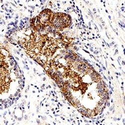 Invitrogen S-arrestin Monoclonal Antibody (PDS-1) 100 &mu;L | Buy Online | Invitrogen&trade; | Fisher Scientific