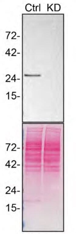 Invitrogen RAB27A Monoclonal Antibody (4D3F11) 100 &mu;g; Unconjugated:Antibodies,