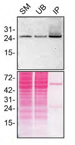 Invitrogen RAB27A Monoclonal Antibody (4D3F11) 100 &mu;g; Unconjugated:Antibodies,