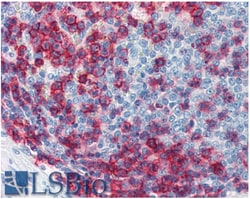Invitrogen CD43 Monoclonal Antibody (MEM-59) 100 &mu;g; Unconjugated:Antibodies,