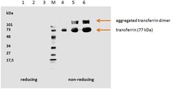 Invitrogen Transferrin Monoclonal Antibody (HTF-14) 100 &mu;g | Buy Online | Invitrogen&trade; | Fisher Scientific