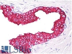 Invitrogen Cytokeratin 5/8 Monoclonal Antibody (C-50) 100 &mu;g; Unconjugated:Antibodies,