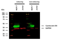 Invitrogen Cytokeratin 5/8 Monoclonal Antibody (C-50) 100 &mu;g; Unconjugated:Antibodies,