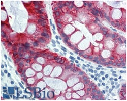 Invitrogen Cytokeratin 18 Monoclonal Antibody (DC-10) 100 &mu;g; Unconjugated:Antibodies,