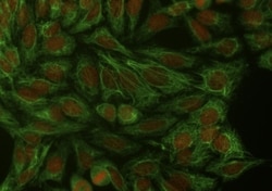 Invitrogen Cytokeratin 18 Monoclonal Antibody (DA-7) 100 &mu;g; Unconjugated:Antibodies,