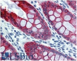 Invitrogen Cytokeratin 18 Monoclonal Antibody (DA-7) 100 &mu;g; Unconjugated:Antibodies,