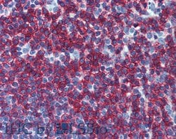 Invitrogen CD45RB Monoclonal Antibody (MEM-55) 100 &mu;g; Unconjugated:Antibodies,