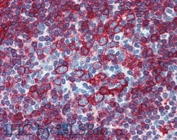 Invitrogen HLA-DR/DP Monoclonal Antibody (HL-38) 100 &mu;g; Unconjugated:Antibodies,