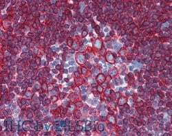 Invitrogen HLA-DR/DP Monoclonal Antibody (HL-40) 100 &mu;g; Unconjugated:Antibodies,