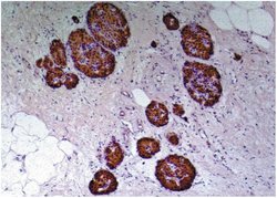 C-Peptide Monoclonal Antibody (C-PEP-01), Invitrogen 100 &mu;g; Unconjugated:Antibodies,
